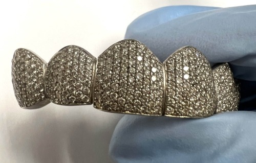 14K Gold & Diamond Teeth Grillz (Pompano Beach, FL)