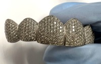 14K Gold & Diamond Teeth Grillz (Pompano Beach, FL)