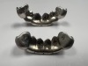 14K Gold & Diamond Teeth Grillz (Pompano Beach, FL) - 4