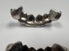 14K Gold & Diamond Teeth Grillz (Pompano Beach, FL) - 5