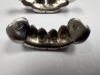 14K Gold & Diamond Teeth Grillz (Pompano Beach, FL) - 6