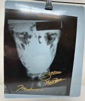 1973 Ali Broken Jaw X-Ray (Dayton, NJ)
