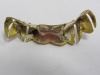 14K Gold Teeth Grillz (Laredo, TX) - 5